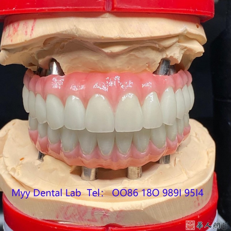 3D打印義齒出口 CAD/CAM義齒加工 數字化種植導板